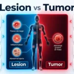 difference between lesion and tumor